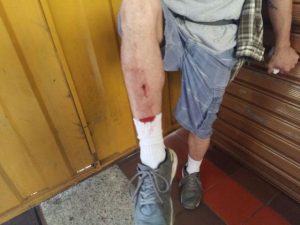 Herido pierna Roberto Casado (1)